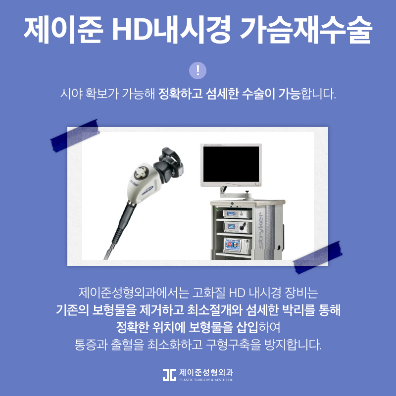 가슴재수술 , 실패 원인에 따른 수술 계획이 중요 관련 이미지 6