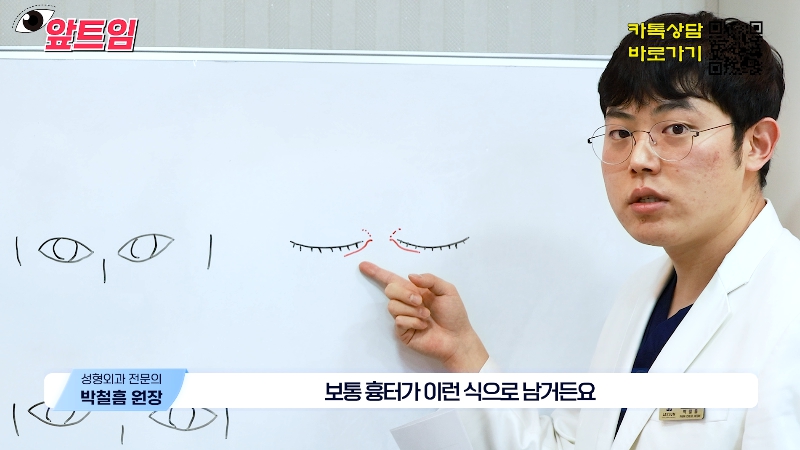 [Jaejune Plastic Surgery & Dermatology] Why is epicanthoplasty necessary? Everything about epicanthoplasty!! image 28
