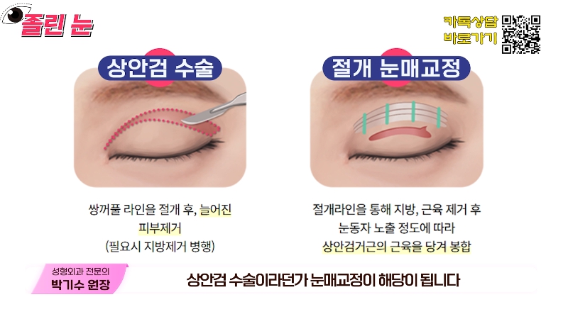 [제이준성형외과&middot;피부과] 졸려보이는 눈과 이마 주름의 상관관계? 관련 이미지 16
