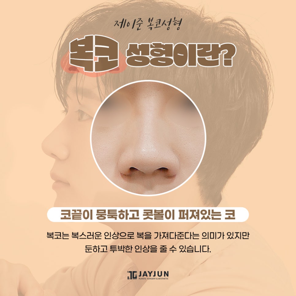 [제이준성형외과] 어떤 각도에서도 자신있는! 제이준 복코 성형 관련 이미지 3