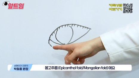 [Jaejune Plastic Surgery & Dermatology] Why is epicanthoplasty necessary? Everything about epicanthoplasty!! image 3