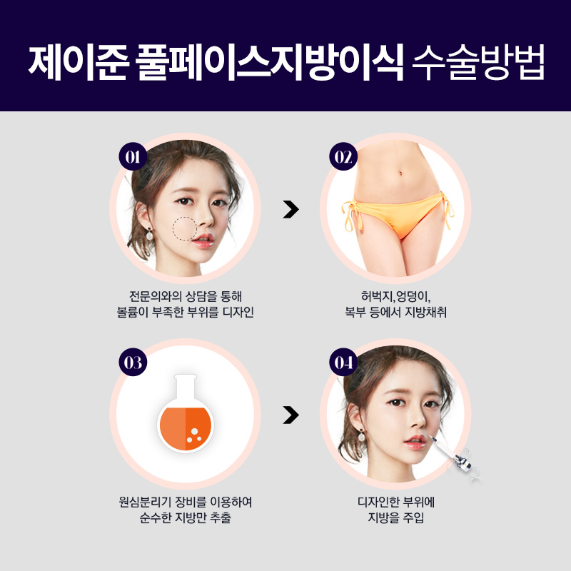 강남역성형외과, 풀페이스지방이식에 관한 정보공유! 관련 이미지 3