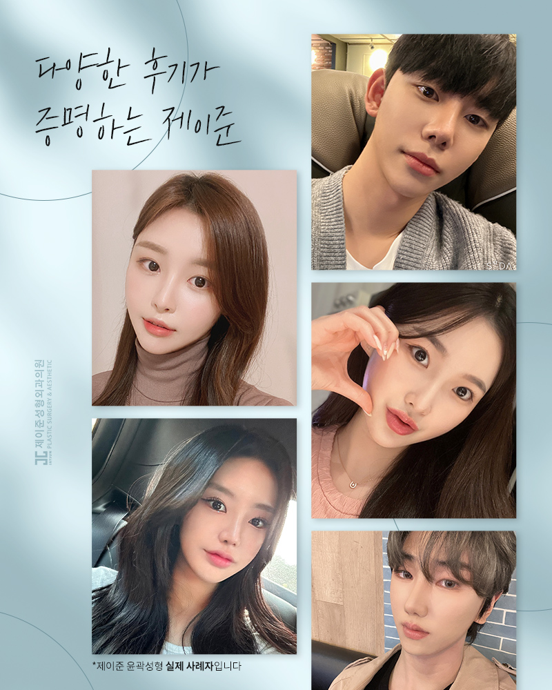 조화와 균형을 다 잡은 제이준성형외과 안면윤곽 관련 이미지 8
