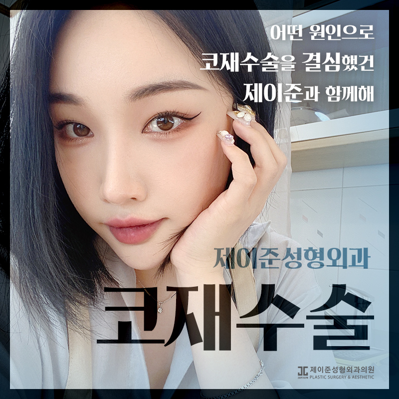 언주역성형외과 제이준의 코재수술 관련 이미지 1