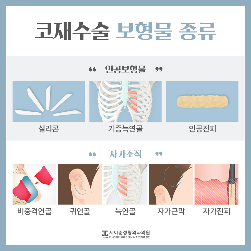 언주역성형외과 제이준의 코재수술 관련 이미지 7