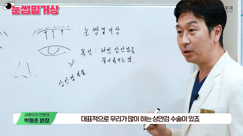 [제이준성형외과&middot;피부과] 쌍꺼풀 라인 변화 없이 눈매 개선은 확실하게! #눈썹밑거상 관련 이미지 3