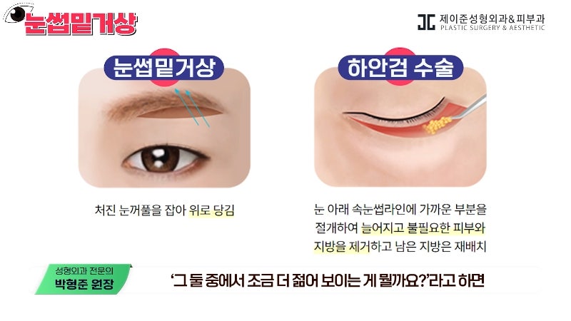 [Jayjun Plastic Surgery & Dermatology] Worried about drooping eyelids? Solve sagging eyes with a brow lift under the eyebrows without double eyelid surgery! image 23