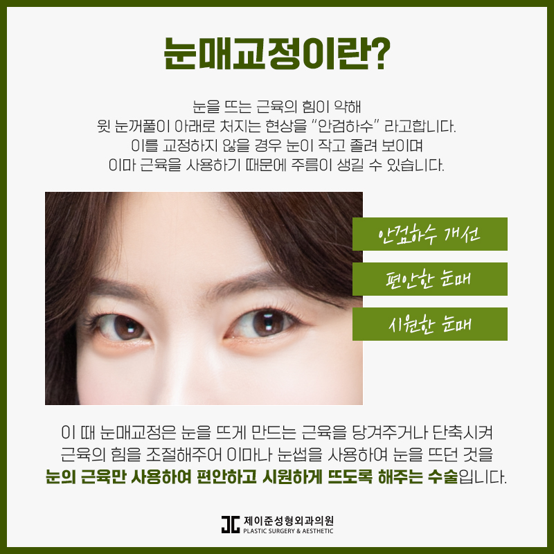 또렷한 눈을 위한 눈매교정 알아보기 관련 이미지 2