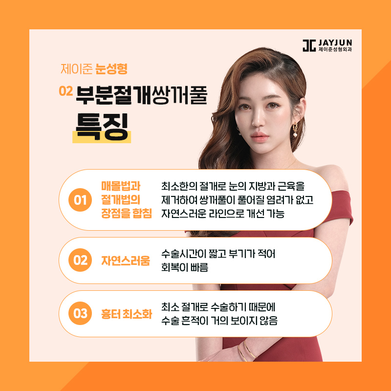 쌍꺼풀수술 종류 알아보기 관련 이미지 6