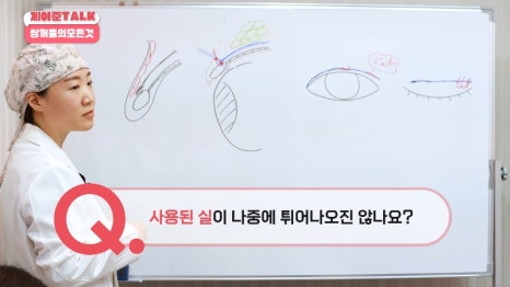 [제이준성형외과&middot;피부과] 비절개&middot;부분절개&middot;절개 쌍꺼풀의 원리와 차이점! 관련 이미지 32
