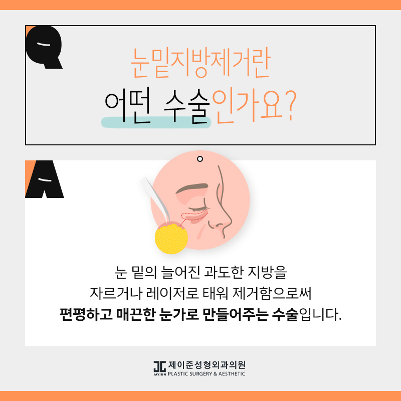 눈밑지방제거 알아보시나요? 관련 이미지 2