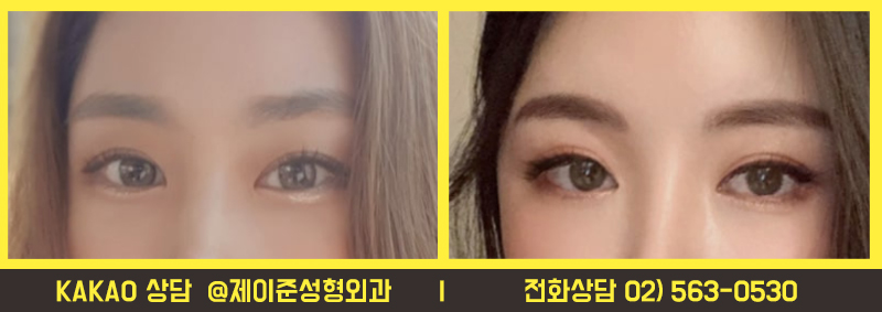 강남역쌍수, 자연유착 할거면 꼭 알아야할 점 관련 이미지 3