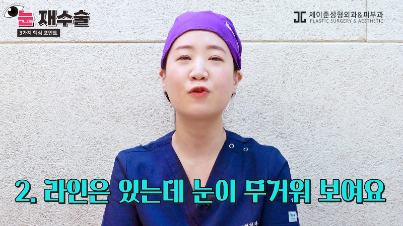 [제이준 유튜브] 눈 재수술을 막기위한 3가지 포인트! 관련 이미지 7
