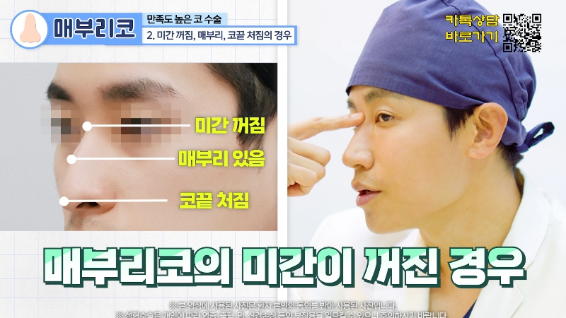 [제이준 유튜브] 유형별 코 성형, 가장 만족도 큰 매부리 코! 관련 이미지 8