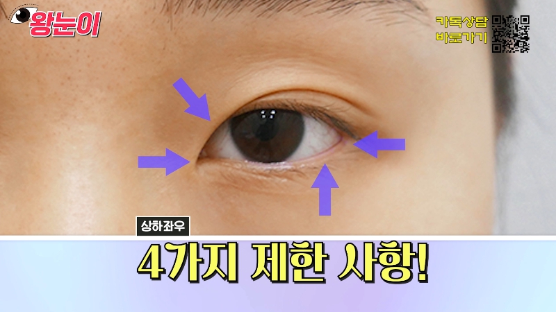 [제이준성형외과&middot;피부과] 제이준성형외과 박철흠 원장님이 알려주는 눈이 커지는 방법 핵심요약! 관련 이미지 2