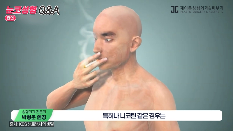 [Jeijun Plastic Surgery & Dermatology] Pre- and Post-Op Q&A: The Must-Know Guide to Eye and Nose Surgery! image 24
