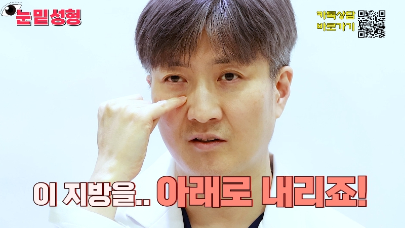 [Jeijun Plastic Surgery & Dermatology&middot;] Lower Blepharoplasty? Lower Eyelid Fat Repositioning? Read This Before Deciding! image 2