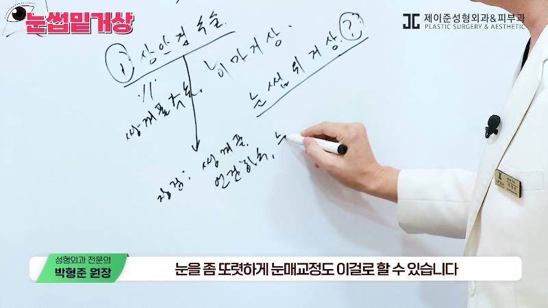 [제이준성형외과&middot;피부과] 쌍꺼풀 라인 변화 없이 눈매 개선은 확실하게! #눈썹밑거상 관련 이미지 9