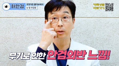 [제이준 유튜브] 하안검 무엇이든 물어보세요! 관련 이미지 4