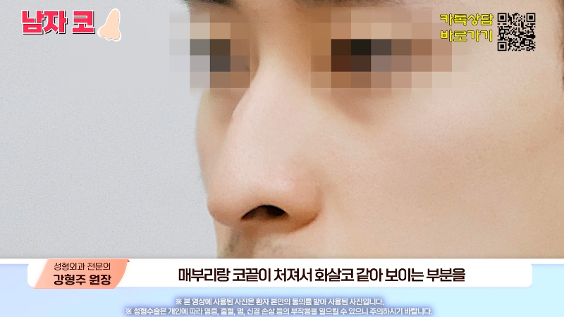 [제이준성형외과&middot;피부과] 남자 인상의 결정적인 부위 관련 이미지 25