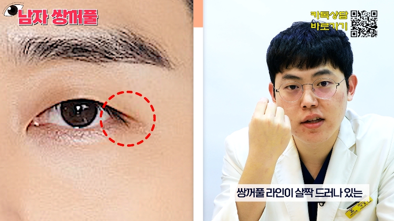 [Jeijun Plastic Surgery & Dermatology] Types and Features of Men’s Double Eyelid Lines Seen Through Celebrities! image 8