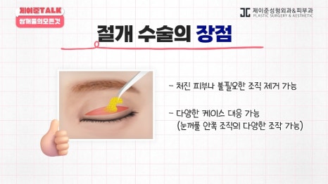 [제이준성형외과&middot;피부과] 비절개&middot;부분절개&middot;절개 쌍꺼풀의 원리와 차이점! 관련 이미지 21