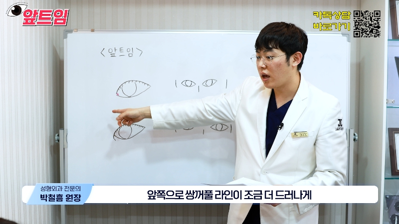 [Jaejune Plastic Surgery & Dermatology] Why is epicanthoplasty necessary? Everything about epicanthoplasty!! image 14