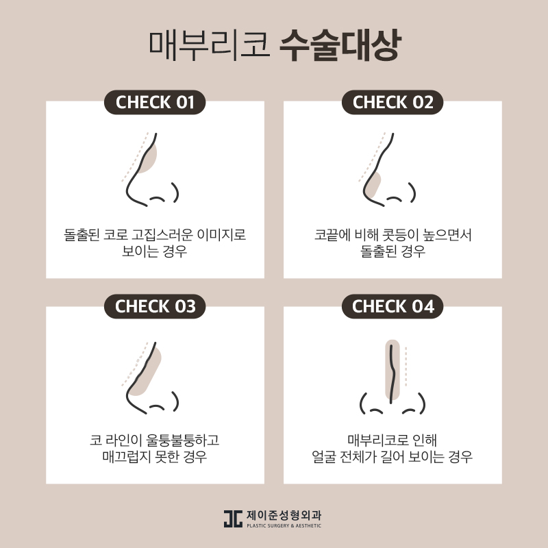 매부리코 교정 , 유형과 상태에 따라 진행돼야 관련 이미지 4