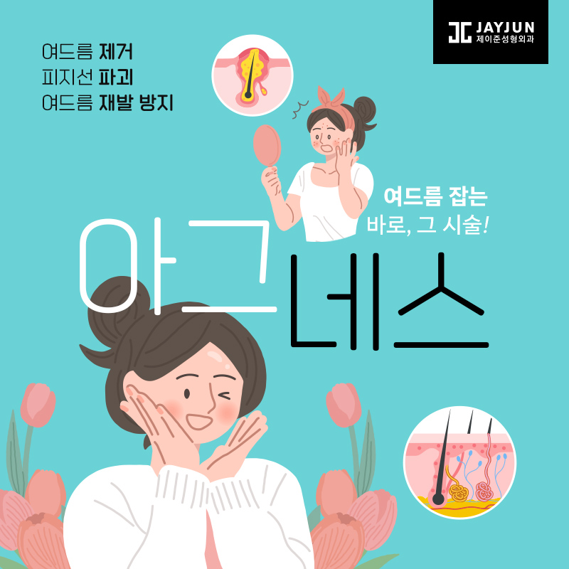 아그네스 , 여드름을 박멸시키고 싶다면! 관련 이미지 1