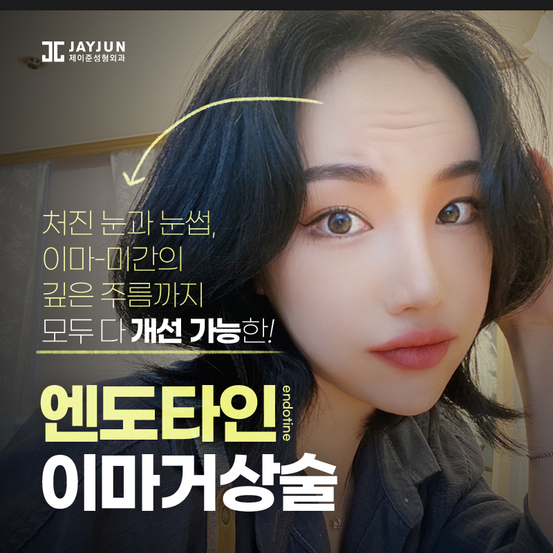 엔도타인 이마거상술 추천드리는 곳 관련 이미지 1