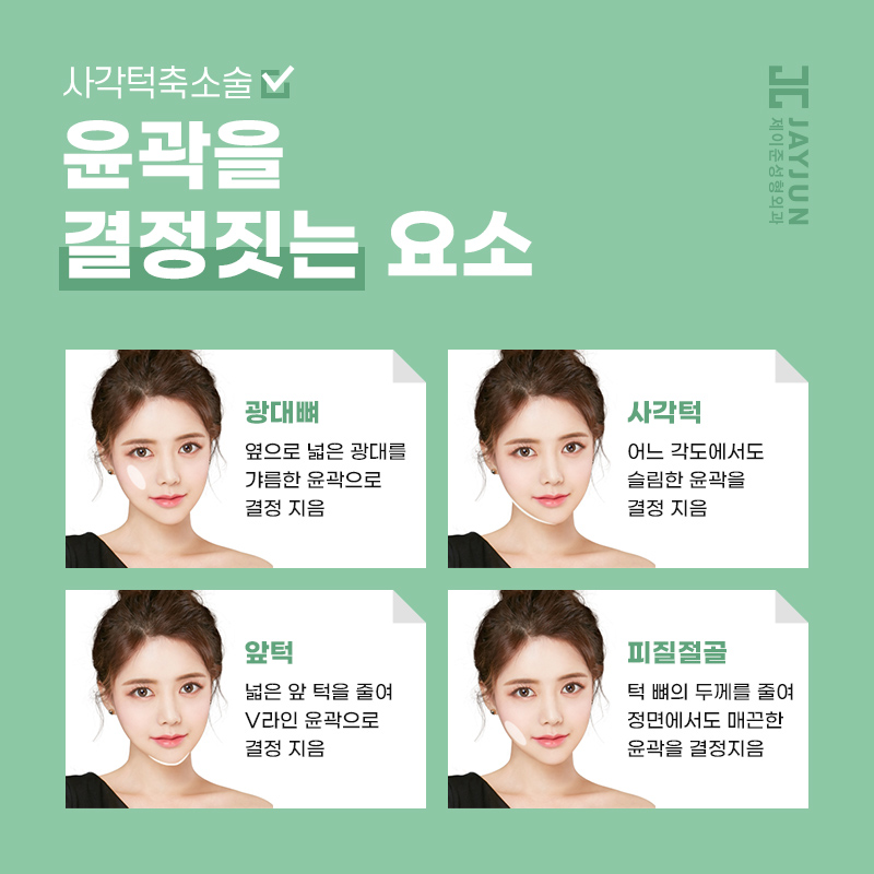 어느 각도에서 봐도 갸름한 얼굴형! 제이준 사각턱축소술 관련 이미지 8