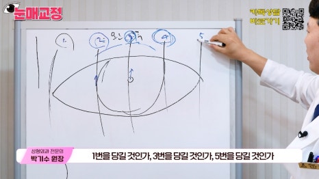 [제이준성형외과&middot;피부과] 눈매교정 파헤치기! 하나부터 열까지 싹~ 알려드립니다! 관련 이미지 14
