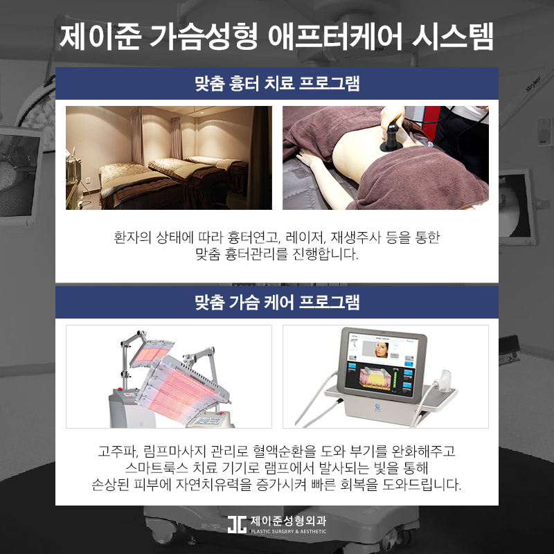 가슴재수술 , 실패 원인에 따른 수술 계획이 중요 관련 이미지 10
