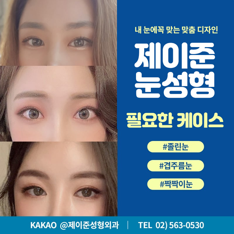 맞춤 눈매교정 눈성형을 원한다면 ? 제이준성형외과에서 ! 관련 이미지 2