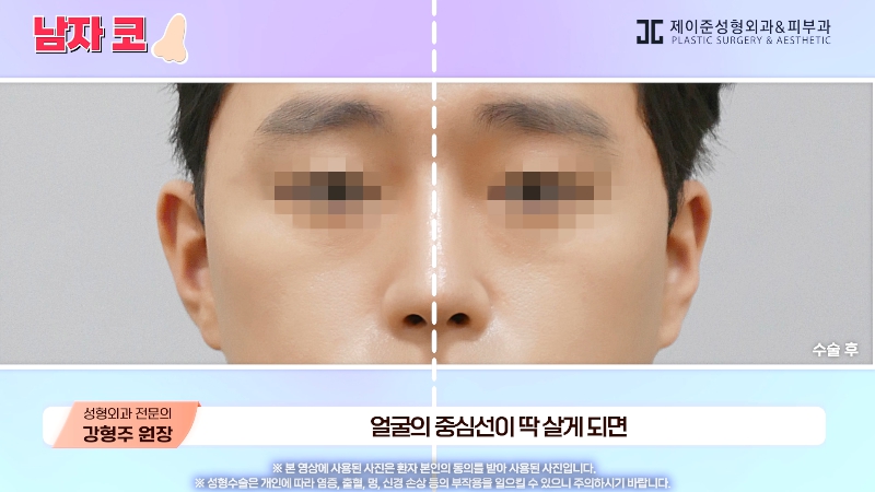[제이준성형외과&middot;피부과] 남자 인상의 결정적인 부위 관련 이미지 28