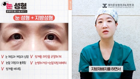 [제이준 유튜브] 눈 성형, 함께 하면 효과 좋은 수술 BEST 3! 관련 이미지 11