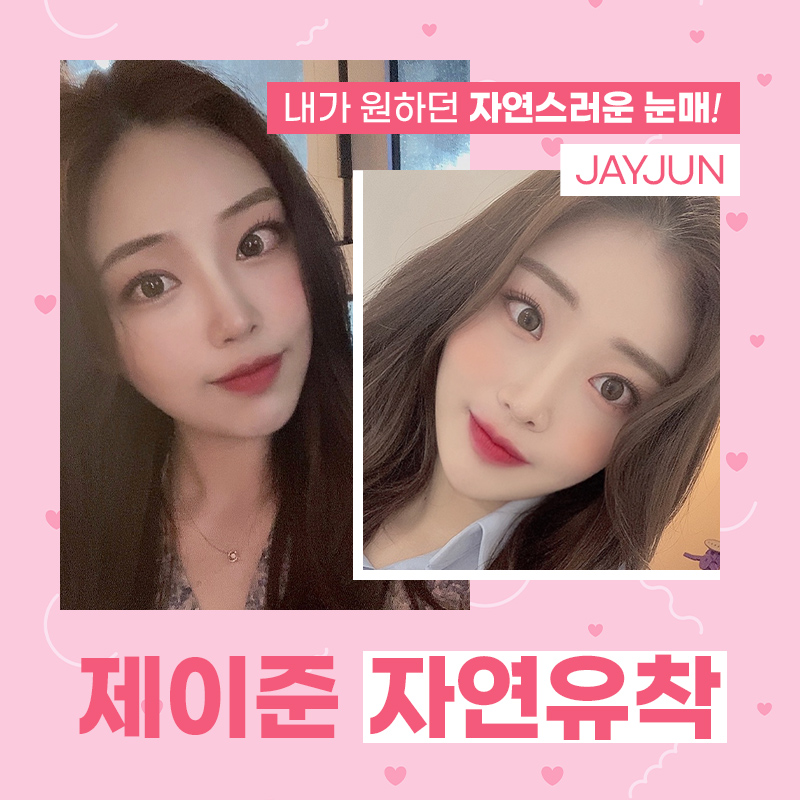자연스러운 눈매를 위한 제이준 자연유착 관련 이미지 6