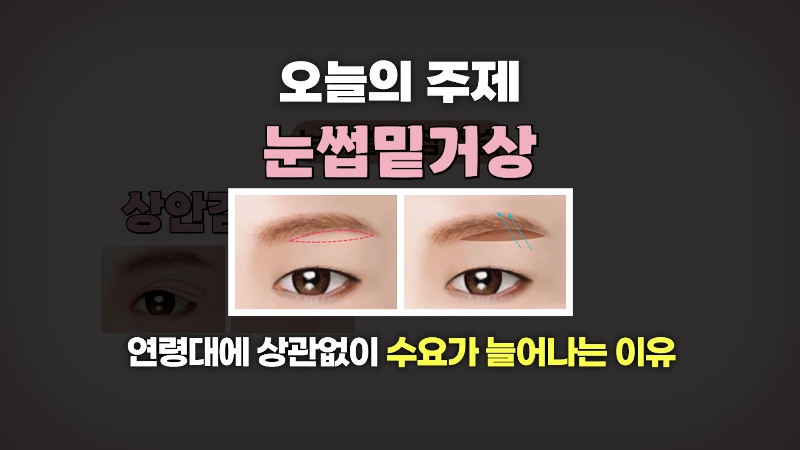 [Jaejune Plastic Surgery & Dermatology] The Secret to a Cleaner Eye Area Without Looking Obvious. #BrowboneLift image 1