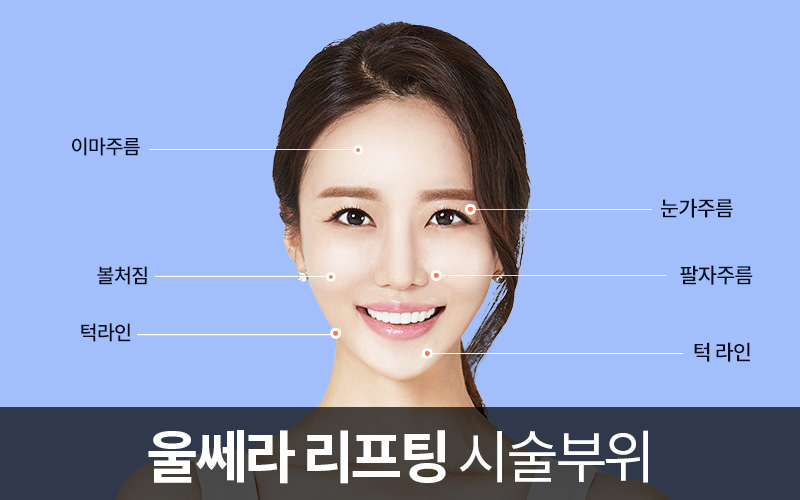 강남 피부과 추천, 제이준 피부과 │ 울쎄라 리프팅 효과 관련 이미지 5