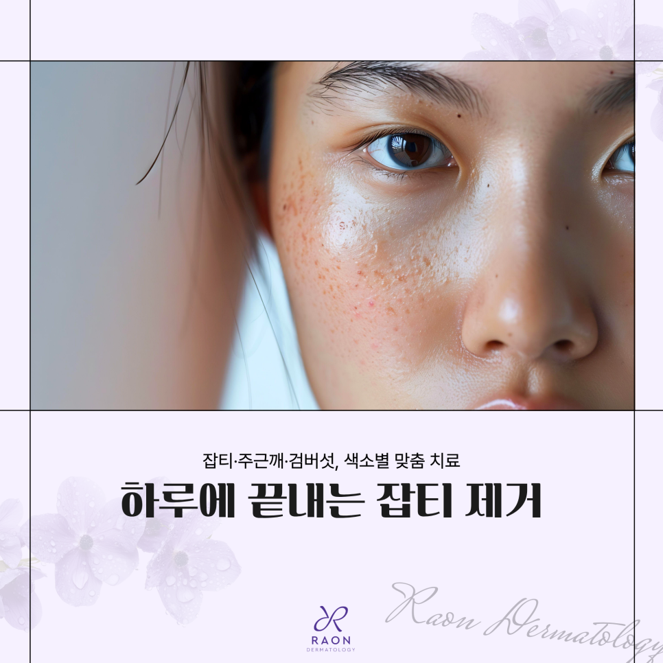 원데이 색소치료 효과 있을까? 왕십리 피부과 전문의 팩트 체크 관련 이미지 1