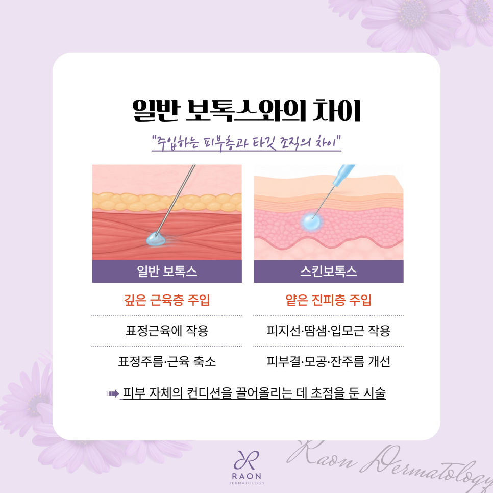 행당역피부과 스킨보톡스 전 수입, 국산 보톡스 3종 비교 [제오민, 코어톡스, 비에녹스] 관련 이미지 3