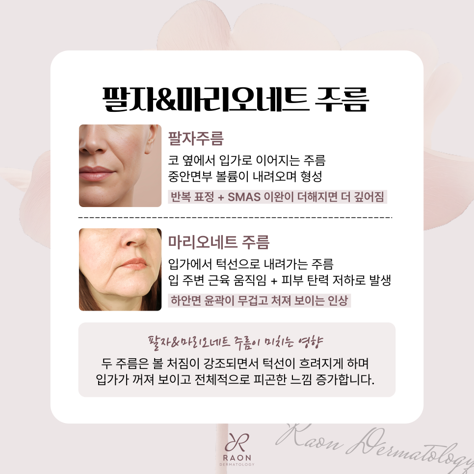 Dermatology Clinic in Seongdong-gu: Improving Nasolabial Folds and Marionette Lines with Ulthera and Juvelook image 3