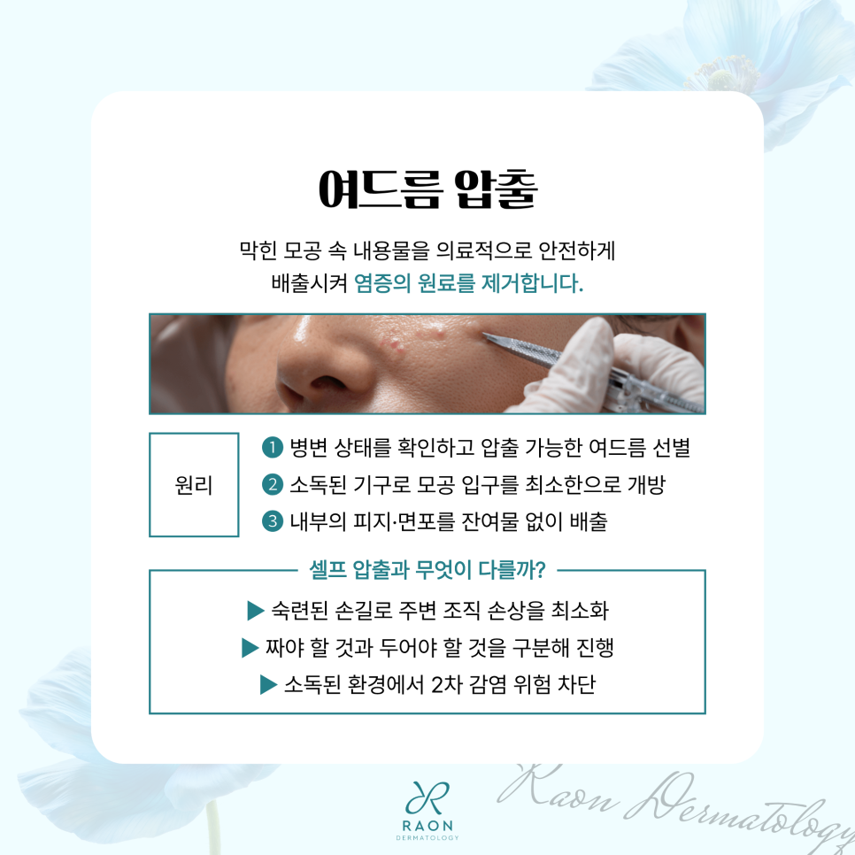 Dermatologist in Gwangjin-gu: The Basics of Acne Care, from Acne Extraction to Sebum and Scars image 3