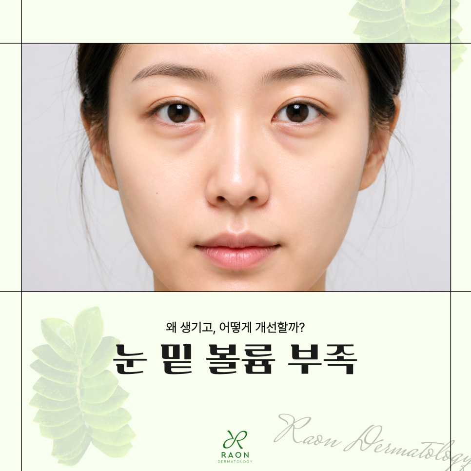 왕십리 피부과 눈 밑 꺼짐 및 볼륨 부족 리투오와 레티젠이 적합한 이유? 관련 이미지 1