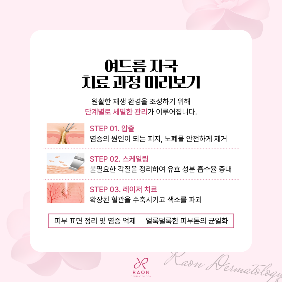 Gangdong-dong Dermatology Specialist Acne Inflammation Mark Treatment Preview, Including Laser Treatment image 3