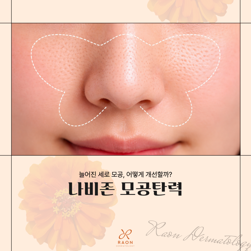 Seongdong-gu Dermatology: Two Ways to Manage Enlarged Pores and Loss of Firmness in the Butterfly Zone [Potenza & ReSFX] image 1