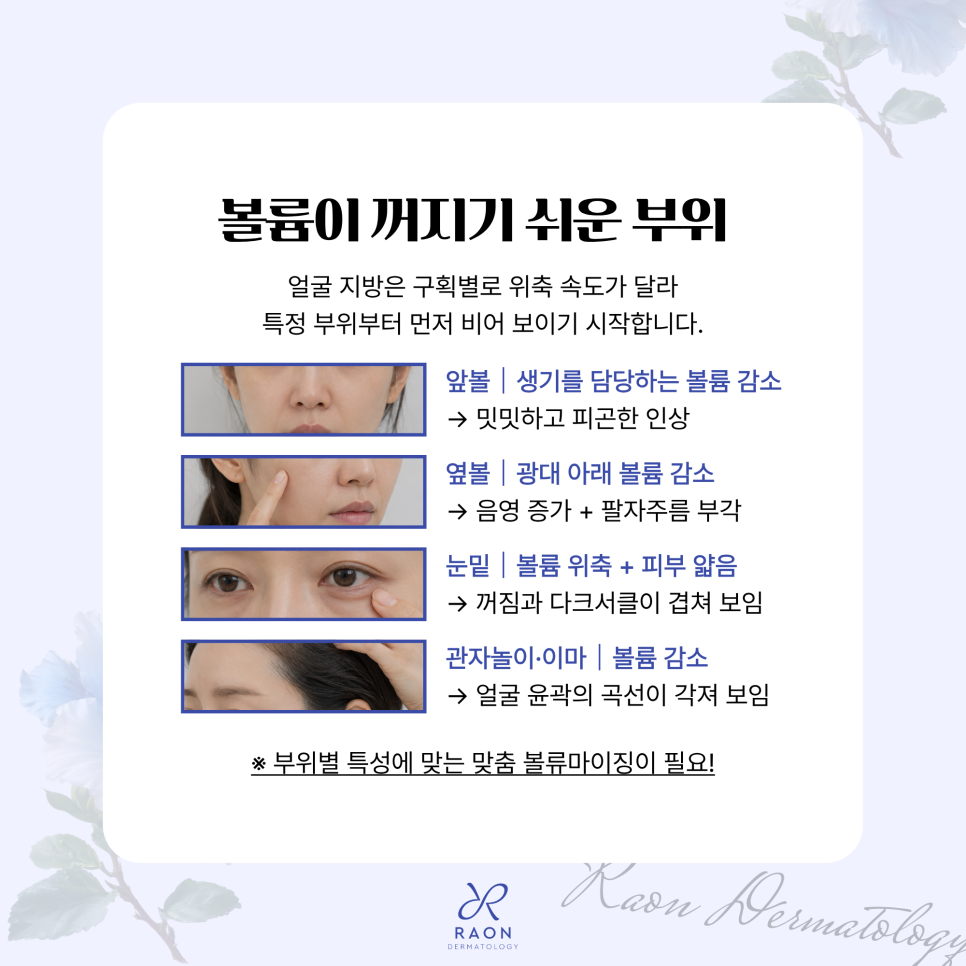 앞볼부터 눈밑과 관자놀이까지 왕십리 피부과 얼굴 볼륨을 채우는 4가지 선택지 관련 이미지 2