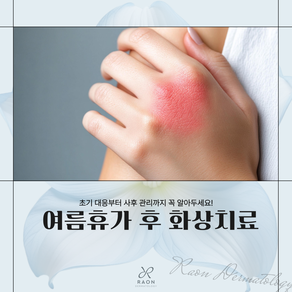 How Is Burn Treatment Handled During a Summer Vacation? From Initial Response to Treatment at a Wangsimni Dermatology Clinic image 1