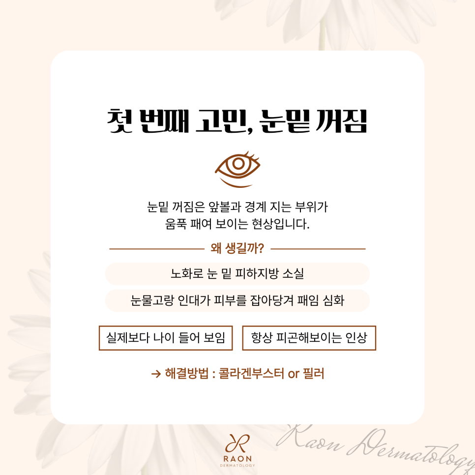 성동구 피부과 눈밑 꺼짐과 지방 돌출 수술 외엔 답이 없을까? [레티젠, 아이울쎄라] 관련 이미지 2