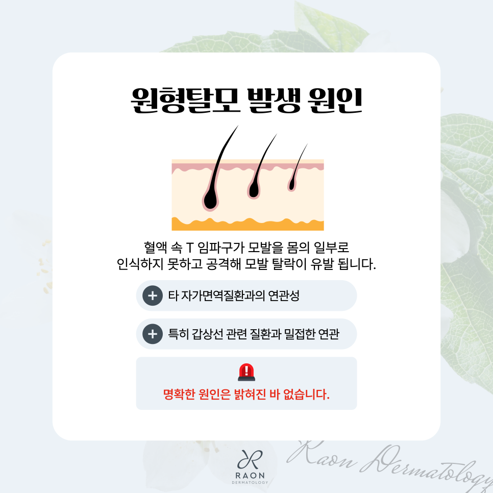 성동구 피부과 원형탈모증 트리암시놀론 주사, 초기 탈모 치료효과는? 관련 이미지 3